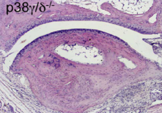 Quinasas p38γ and p38δ